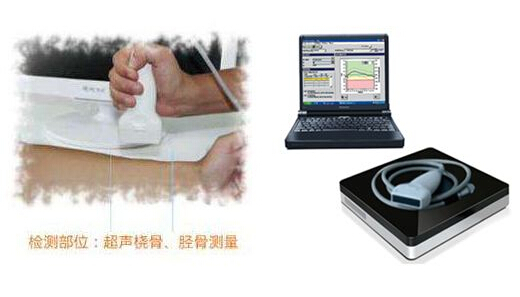 超声波骨密度仪厂家支招想要知道自己骨密度情况,哪些人该检查?