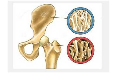 超声波骨密度仪厂家支招想要知道自己骨密度情况,哪些人该检查?