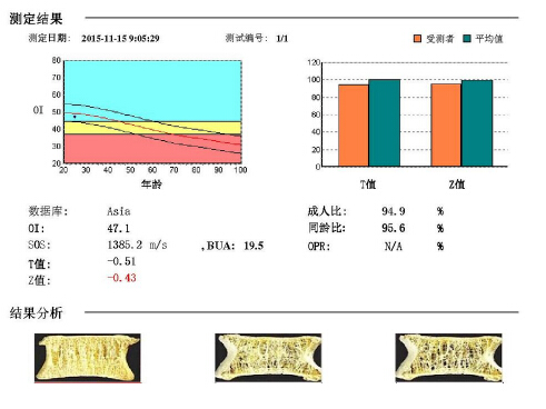 骨密度仪阐述骨质疏松青年不注意老来徒悲伤骨质流失比你想的可怕