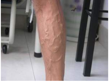 骨密度仪厂家关爱老师健康别让这些职业病缠身教师节快乐