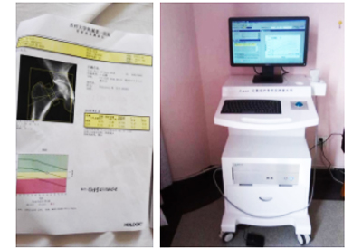 骨密度仪康复科检验神器"C位出道"在各大医院门诊体检中心预防骨密度T值低于－2.5