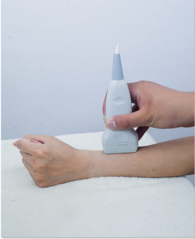 测量桡骨骨密度仪生产厂家检测桡骨和跟骨哪个能够更好的操作市场