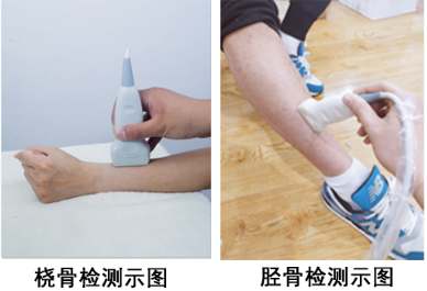 骨密度仪被综合性医院江西南昌长峰医院采购_脚踝测骨密度准吗?