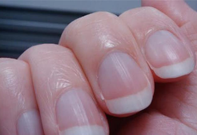 测骨密度仪器从人各方面就能看出你是不是存在骨质疏松