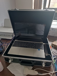 便携式骨密度检测仪厂家