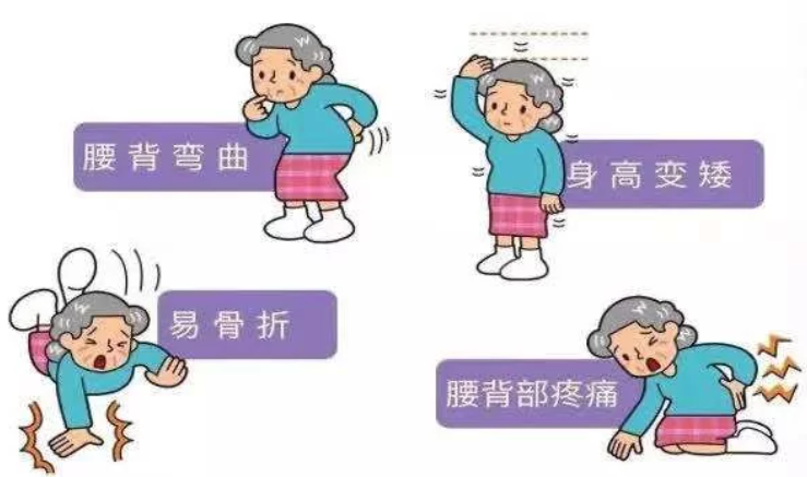 （辽宁沈阳）超声骨密度检测分析仪警惕骨质疏松 骨密度筛查也很重要！